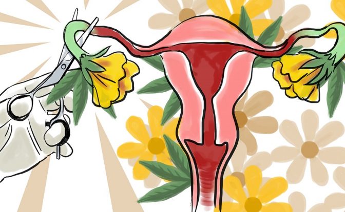 mujeres esterilización Nicaragua